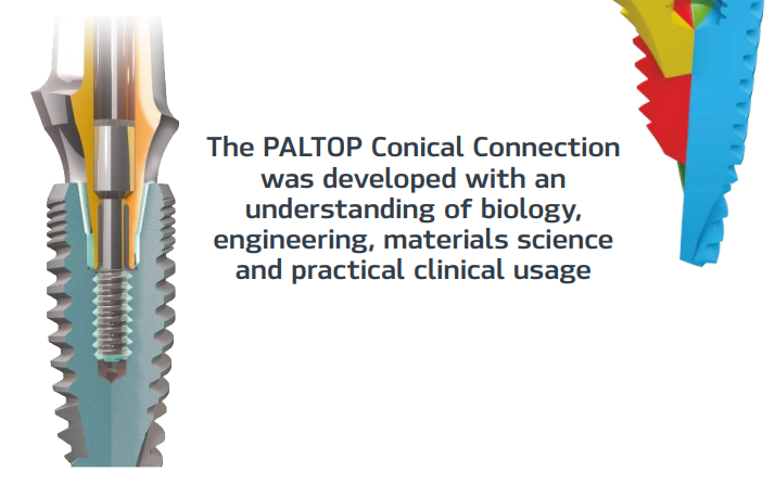 paltop implant