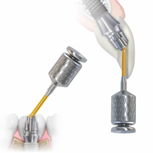 Conical ACS Abutment