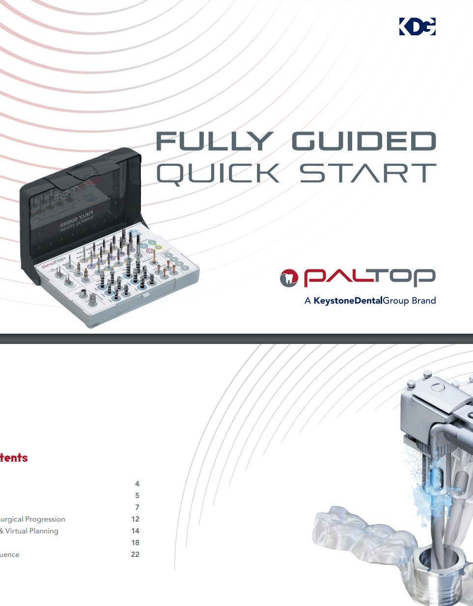Paltop Fully Guided Quick Start