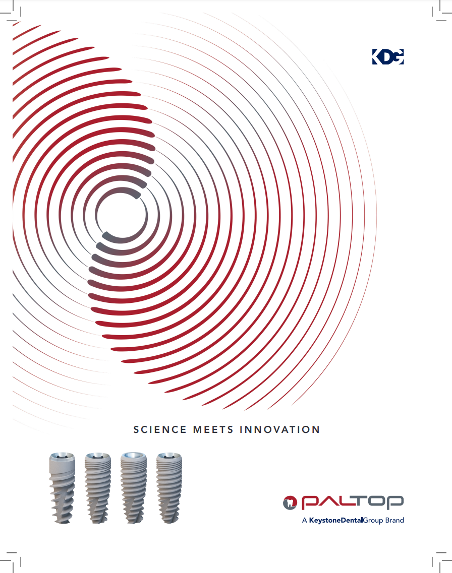 Brochure Paltop Dental Implants
