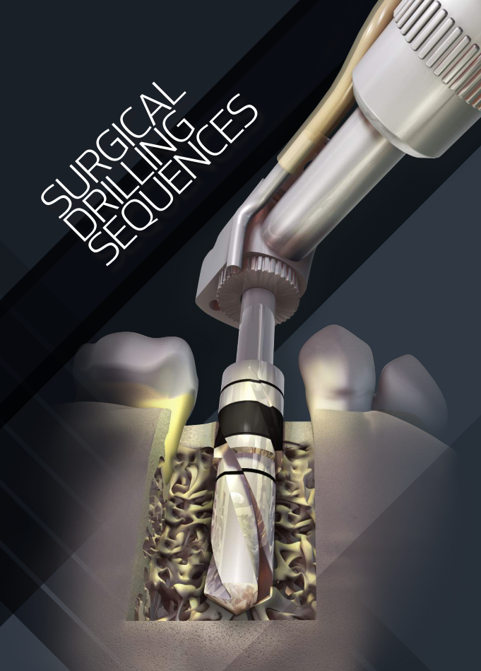 Surgical Drilling Sequences